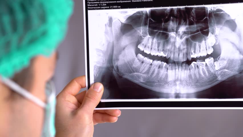 Digital Dental Xray