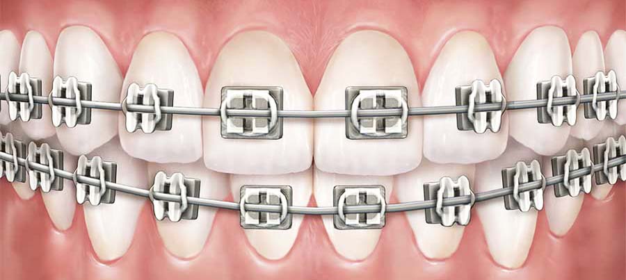 orthodontic treatment clinic in mansarovar jaipur